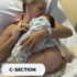 Pregnancy & C-Section 3-in-1 Belly Band