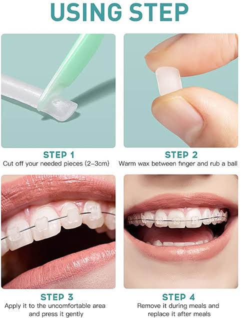 Piksters® Orthodontic Wax 牙套蜡